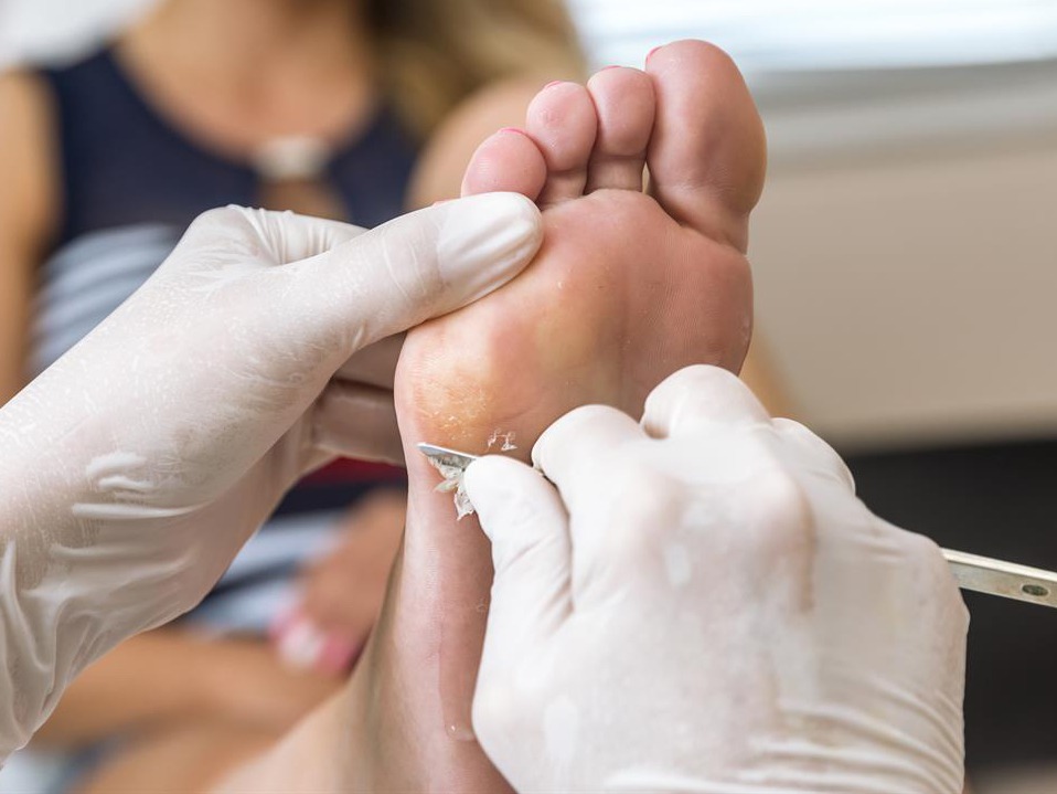 Callosidades Uruapan by Slypc